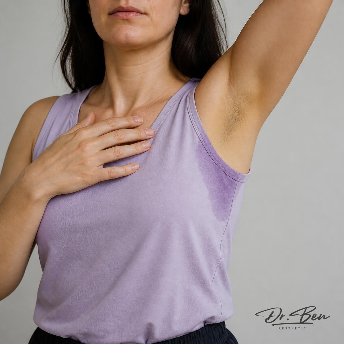 Illustrative image of an adult with one arm raised, showing a visible damp patch on the underarm of a sleeveless top typical of mild-to-moderate underarm hyperhidrosis