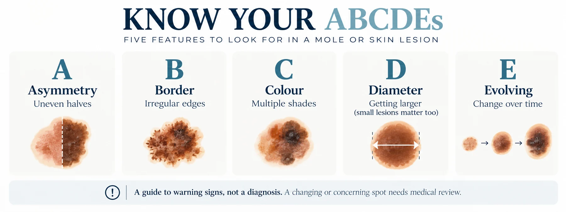 ABCDE warning signs for melanoma: asymmetry, border, colour, diameter and evolving
